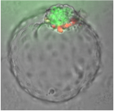 Live image of a human blastoid