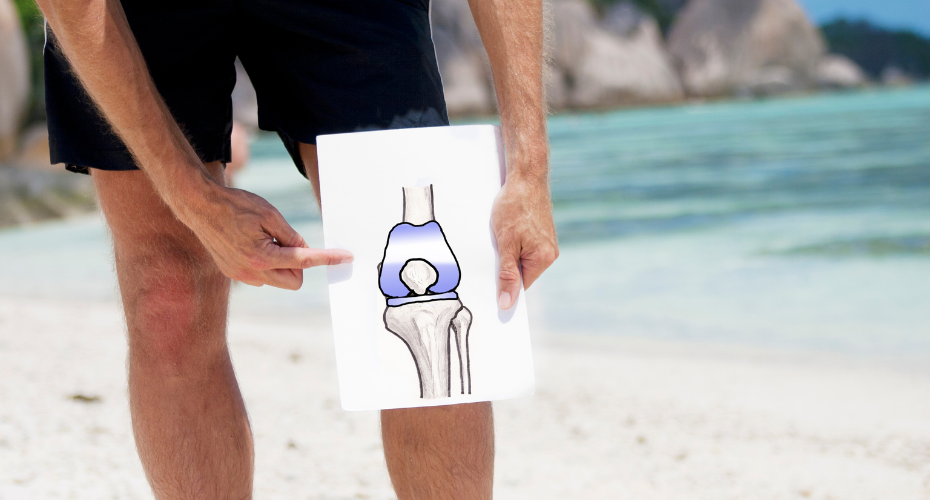 Man holding an image of a knee replacement 