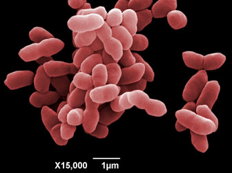 SEM of bacteria <em>Burkholdria thailandensisl</em>. Mag x15k. Image by Peter Splatt.
