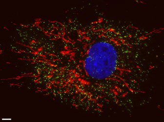 Human skin fibroblast stained for mitochondria (red), peroxisomes (green) and DNA (blue). Scale bar 5µm. Image courtesy of Prof Michael Schrader.