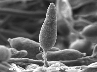 Cryo-SEM of rice blast fungus <em>Magnaporthe grisea</em>, Conidia. Image by Peter Splatt.