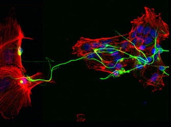 Murine P19 embryonic carcinoma cells differentiate to neurons by retinoic acid (RA). Cells were exposed to RA for 4 days and stained for F-actin with phalloidin (red), axon with anti-acetylated tubulin antibody (green) and nuclei with Hoechst (blue). Scale bar 50µm. Image taken by Dr Aya Takesono, courtesy of Dr Tetsu Kudoh.