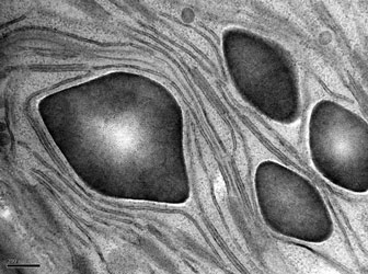 TEM of starch granules in chloroplast of maize leaf cell. Mag x80k. Image by Dr Christian Hacker.