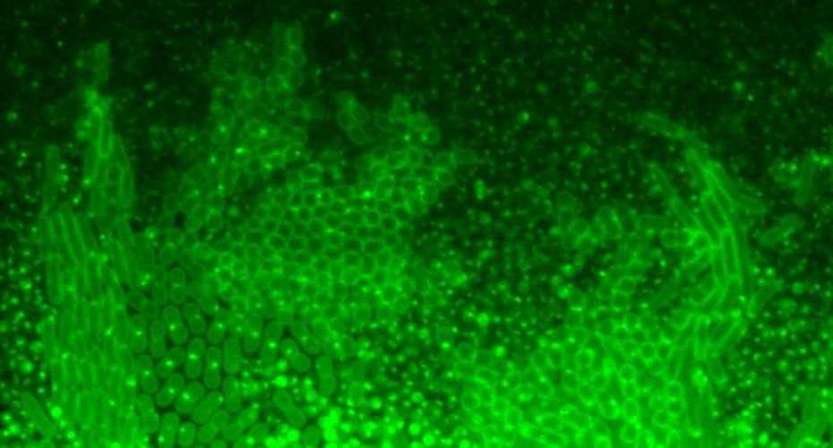 image of green cells as seen through a microscope