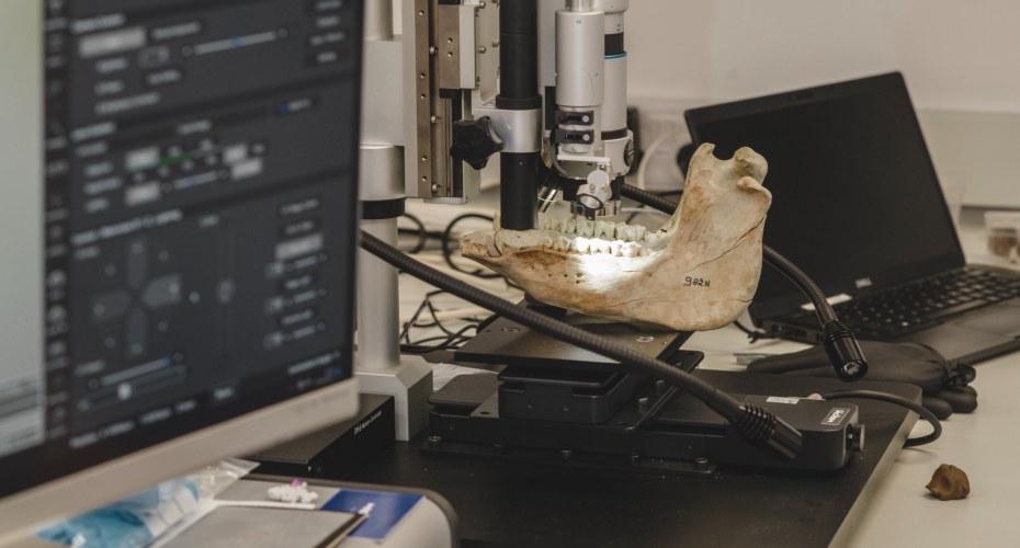Jaw bone being inspected under micrscope in lab